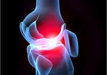 HIỆU QUẢ CỦA GLUCOSAMIN TRONG ĐIỀU TRỊ ĐAU XƯƠNG KHỚP